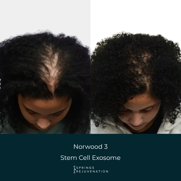 Before and After Results